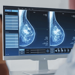 A breast cancer screening.