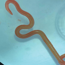 roundworm removed from woman's brain